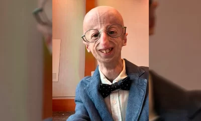 Sammy Basso tenía progeria de Hutchinson-Gilford, una enfermedad genética extremamente rara que provoca el envejecimiento prematuro y acelerado.