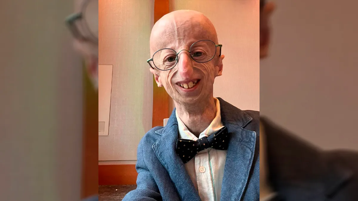 Sammy Basso tenía progeria de Hutchinson-Gilford, una enfermedad genética extremamente rara que provoca el envejecimiento prematuro y acelerado.