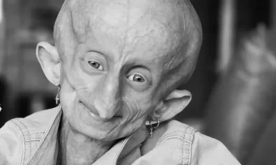 Beandri Booysen, joven sudafricana y estrella de TikTok, fallece a los 19 años tras enfrentar el síndrome de Progeria.