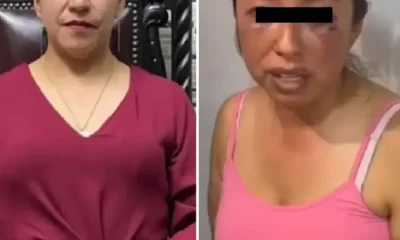 ”. A través de un video difundido en redes sociales, Miriam mostró visibles lesiones en el rostro, lo que generó una fuerte indignación social.