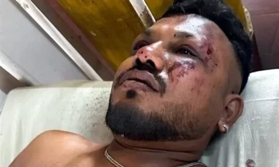 Rakesh relató que, apenas 30 segundos después del despegue, escuchó un fuerte estruendo antes de que la aeronave impactara contra un edificio residencial destinado a médicos. “Todo sucedió rapidísimo.