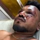 Rakesh relató que, apenas 30 segundos después del despegue, escuchó un fuerte estruendo antes de que la aeronave impactara contra un edificio residencial destinado a médicos. “Todo sucedió rapidísimo.