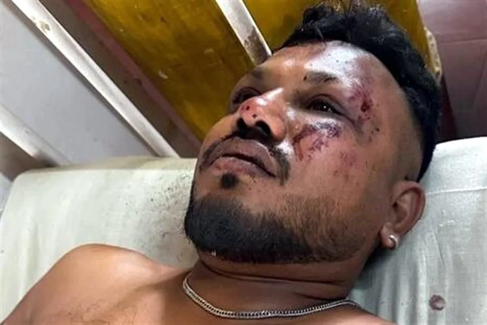 Rakesh relató que, apenas 30 segundos después del despegue, escuchó un fuerte estruendo antes de que la aeronave impactara contra un edificio residencial destinado a médicos. “Todo sucedió rapidísimo.