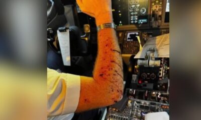 Las imágenes posteriores muestran el parabrisas astillado y la consola central cubierta de fragmentos de vidrio, lo que evidencia la magnitud del riesgo