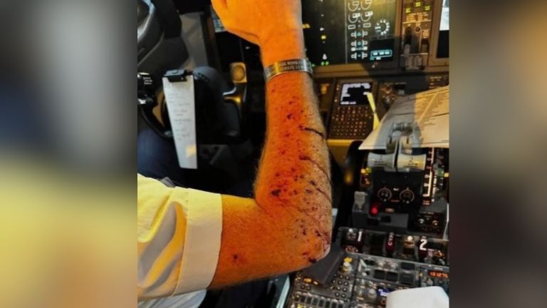 Las imágenes posteriores muestran el parabrisas astillado y la consola central cubierta de fragmentos de vidrio, lo que evidencia la magnitud del riesgo