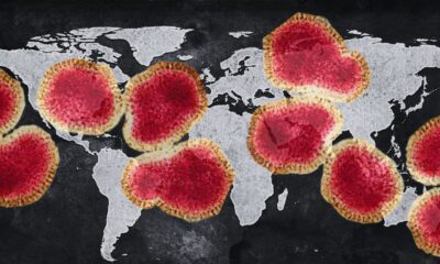 Tras los estudios correspondientes, la autoridad sanitaria precisó que se trató de un caso aislado, sin evidencia de brotes asociados, y subrayó que el manejo clínico aplicado fue el mismo que se utiliza para la influenza estacional.