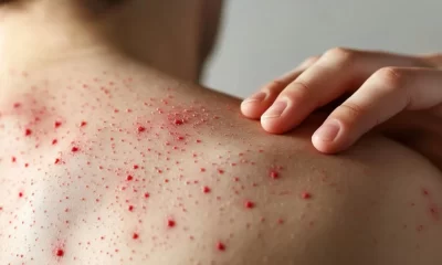 Las autoridades sanitarias señalaron que la medida busca reducir el riesgo de contagio, frenar la velocidad de transmisión del virus y proteger especialmente a la población infantil