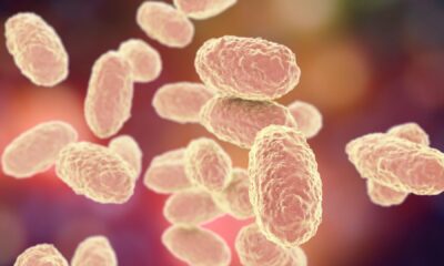 En total, el país acumula 32 contagios confirmados, distribuidos equitativamente entre hombres y mujeres.