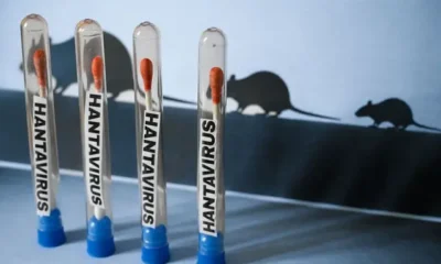 La funcionaria explicó que no existe evidencia de transmisión entre personas asintomáticas, pero insistió en mantener vigilancia médica constante.