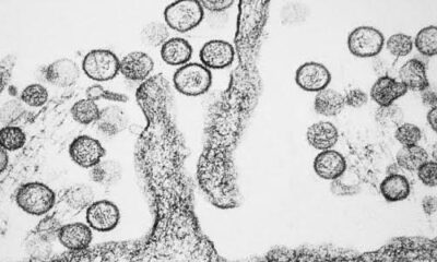 El brote obligó a dar seguimiento a 650 contactos en 33 países, en un operativo internacional de vigilancia epidemiológica